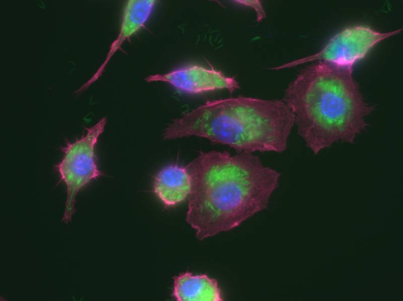child with CF